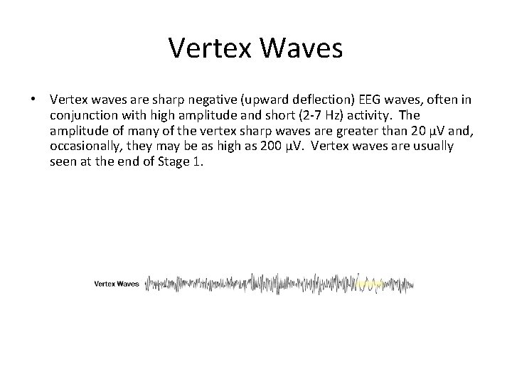 Vertex Waves • Vertex waves are sharp negative (upward deflection) EEG waves, often in