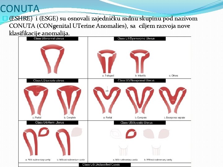 CONUTA � (ESHRE) i (ESGE) su osnovali zajedničku radnu skupinu pod nazivom CONUTA (CONgenital