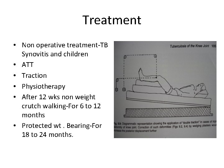 Treatment • Non operative treatment-TB Synovitis and children • ATT • Traction • Physiotherapy