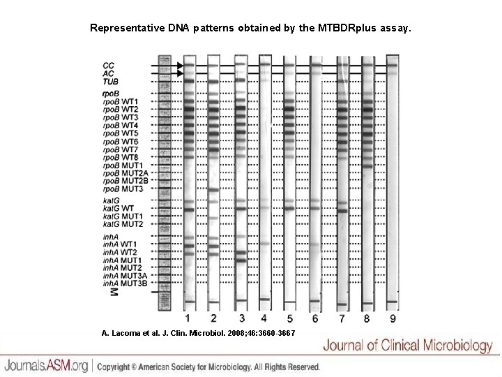 Representative DNA patterns obtained by the MTBDRplus assay. A. Lacoma et al. J. Clin.