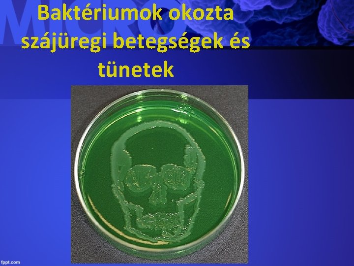 Baktériumok okozta szájüregi betegségek és tünetek 