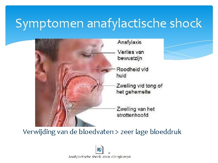 Symptomen anafylactische shock Verwijding van de bloedvaten > zeer lage bloeddruk 11 