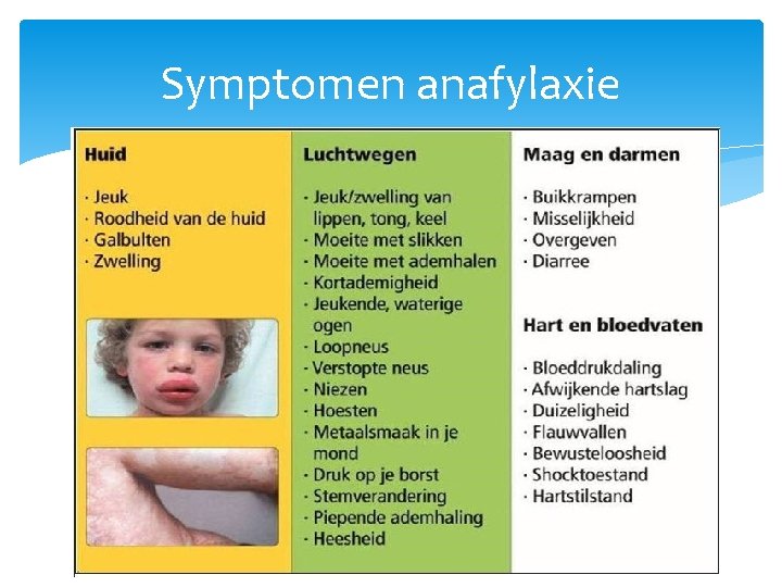 Symptomen anafylaxie 12 