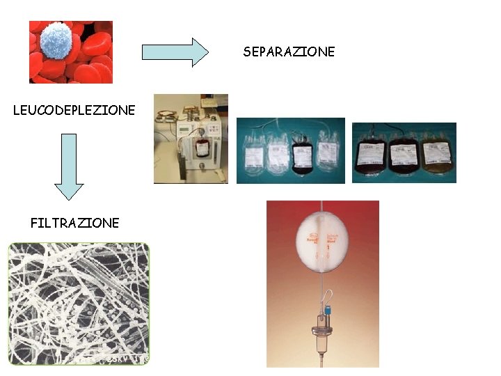 SEPARAZIONE LEUCODEPLEZIONE FILTRAZIONE 