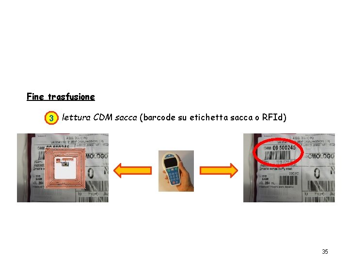 Fine trasfusione 3 lettura CDM sacca (barcode su etichetta sacca o RFId) 35 