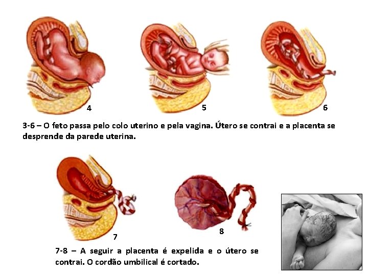 4 5 6 3 -6 – O feto passa pelo colo uterino e pela