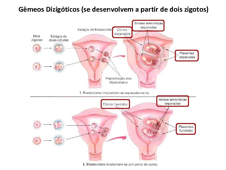Gêmeos Dizigóticos (se desenvolvem a partir de dois zigotos) Gêmeos Dizigóticos (se desenvolvem a partir de dois zigotos)