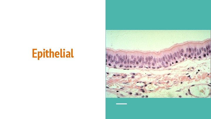 Epithelial 