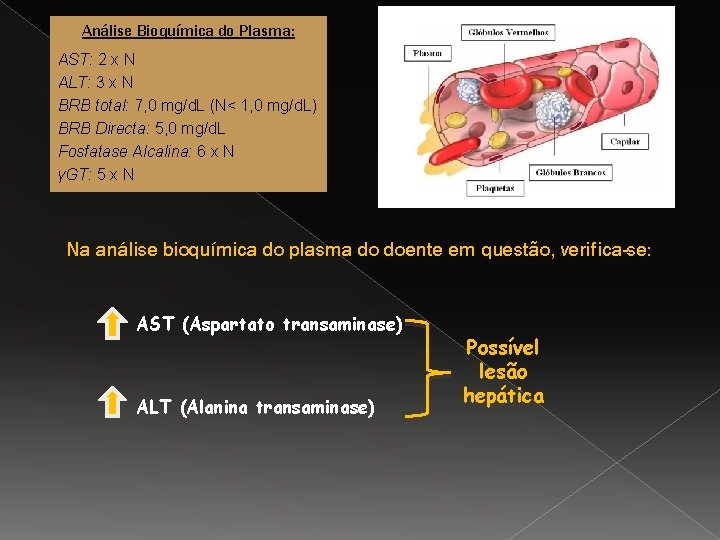Análise Bioquímica do Plasma: AST: 2 x N ALT: 3 x N BRB total: