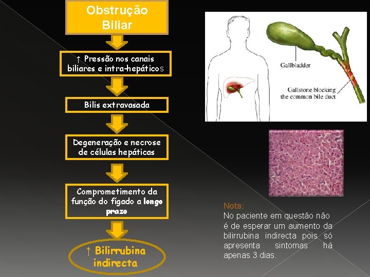 Obstrução Biliar ↑ Pressão nos canais biliares e intra-hepáticos Bilis extravasada Degeneração e necrose