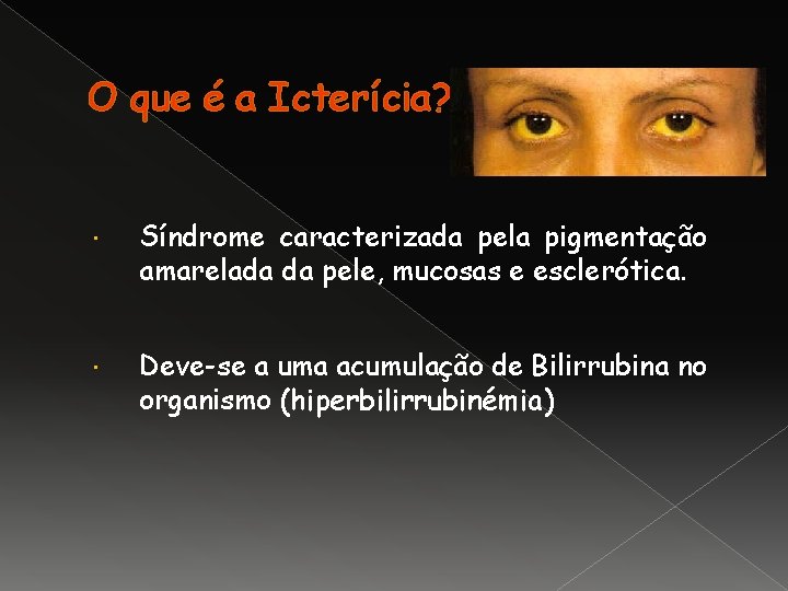 O que é a Icterícia? Síndrome caracterizada pela pigmentação amarelada da pele, mucosas e
