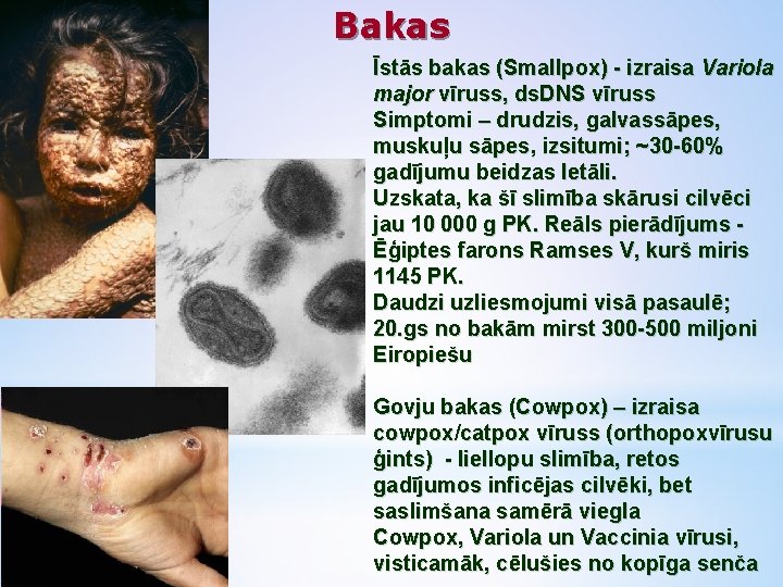 Bakas Īstās bakas (Smallpox) - izraisa Variola major vīruss, ds. DNS vīruss Simptomi –