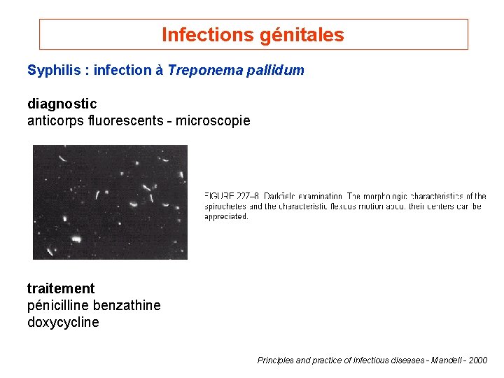 Infections génitales Syphilis : infection à Treponema pallidum diagnostic anticorps fluorescents - microscopie traitement