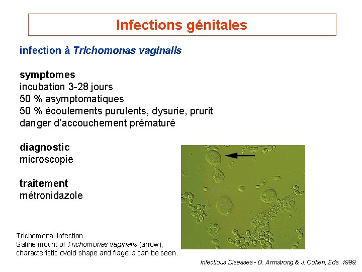 Infections génitales infection à Trichomonas vaginalis symptomes incubation 3 -28 jours 50 % asymptomatiques