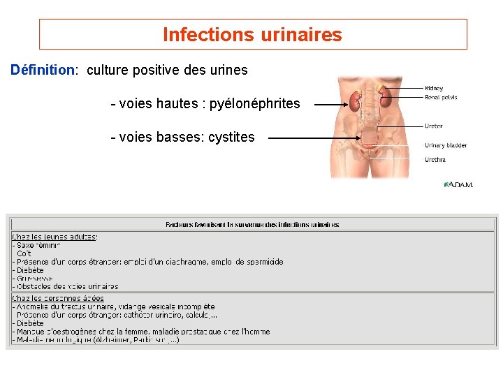 Infections urinaires Définition: culture positive des urines - voies hautes : pyélonéphrites - voies