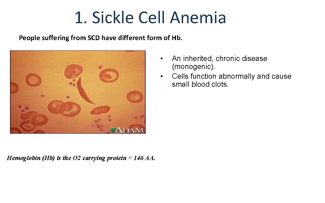 1. Sickle Cell Anemia People suffering from SCD have different form of Hb. •