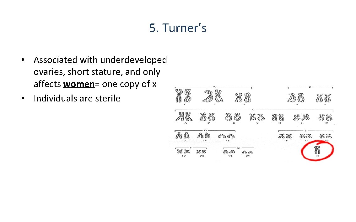 5. Turner’s • Associated with underdeveloped ovaries, short stature, and only affects women= one