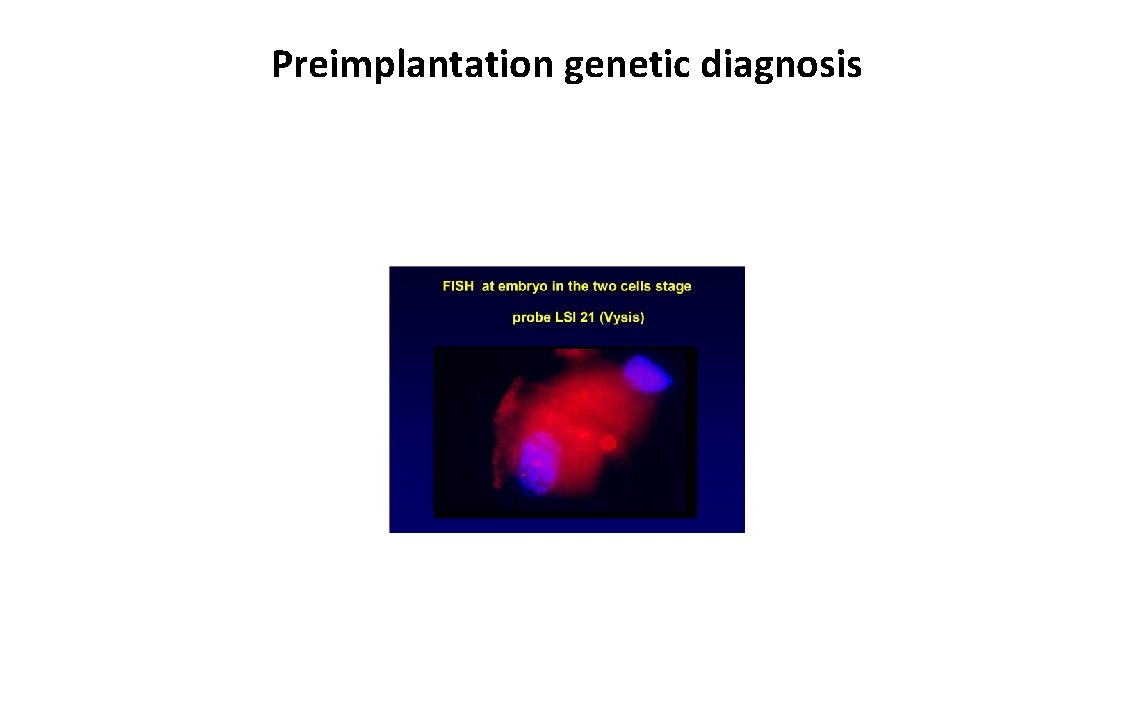 Preimplantation genetic diagnosis 