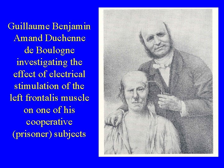 Guillaume Benjamin Amand Duchenne de Boulogne investigating the effect of electrical stimulation of the