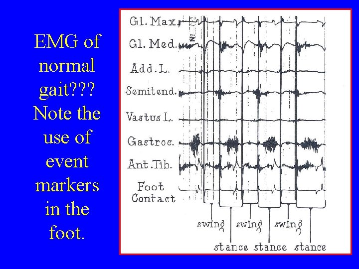 EMG of normal gait? ? ? Note the use of event markers in the