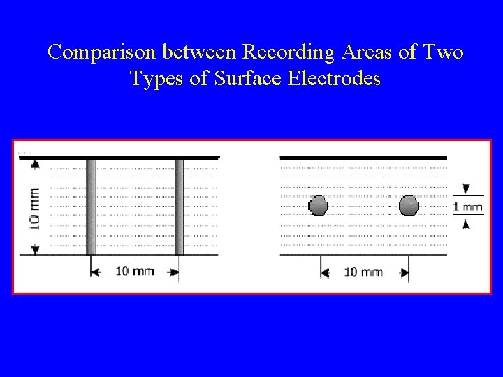Comparison between Recording Areas of Two Types of Surface Electrodes 