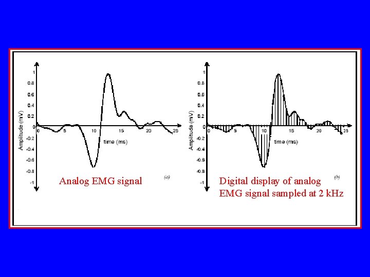 Analog EMG signal Digital display of analog EMG signal sampled at 2 k. Hz