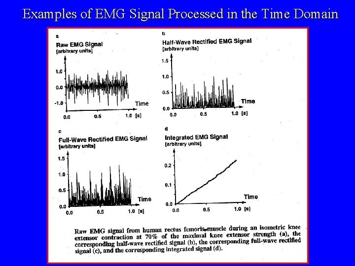 Examples of EMG Signal Processed in the Time Domain 