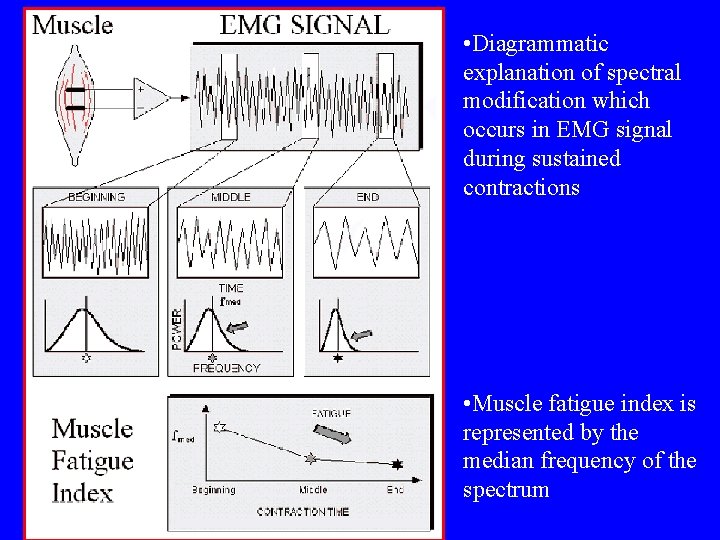  • Diagrammatic explanation of spectral modification which occurs in EMG signal during sustained
