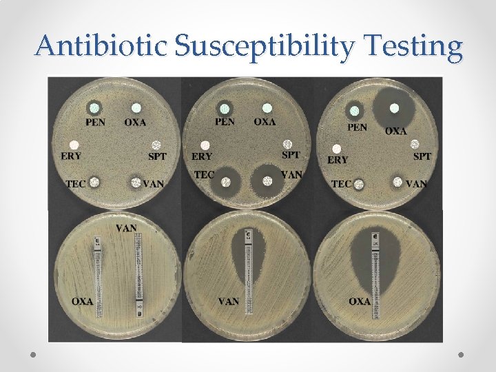 Antibiotic Susceptibility Testing 