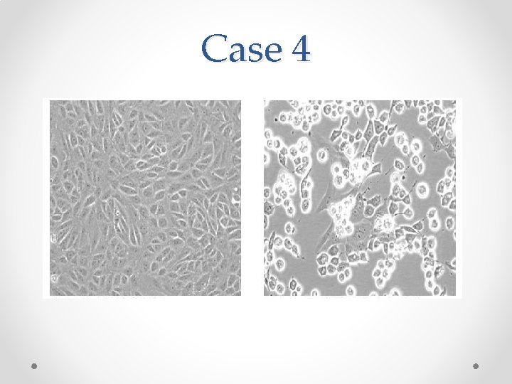 Case 4 