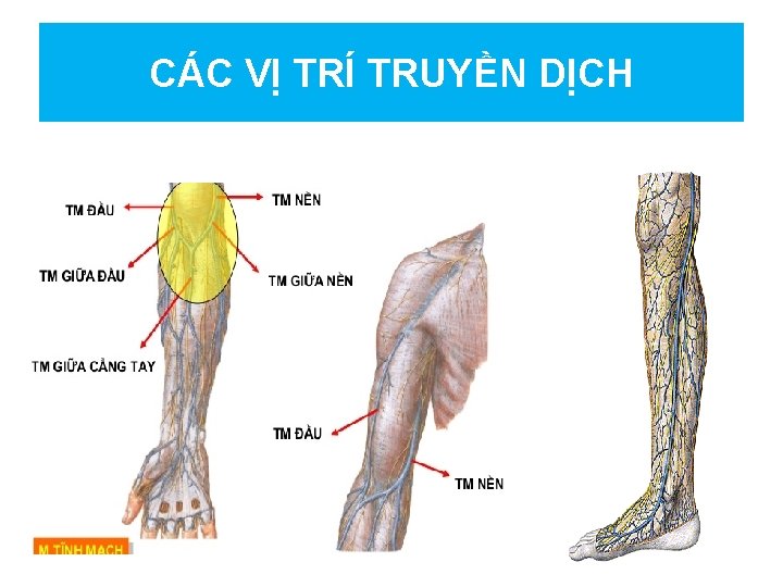 CÁC VỊ TRÍ TRUYỀN DỊCH 