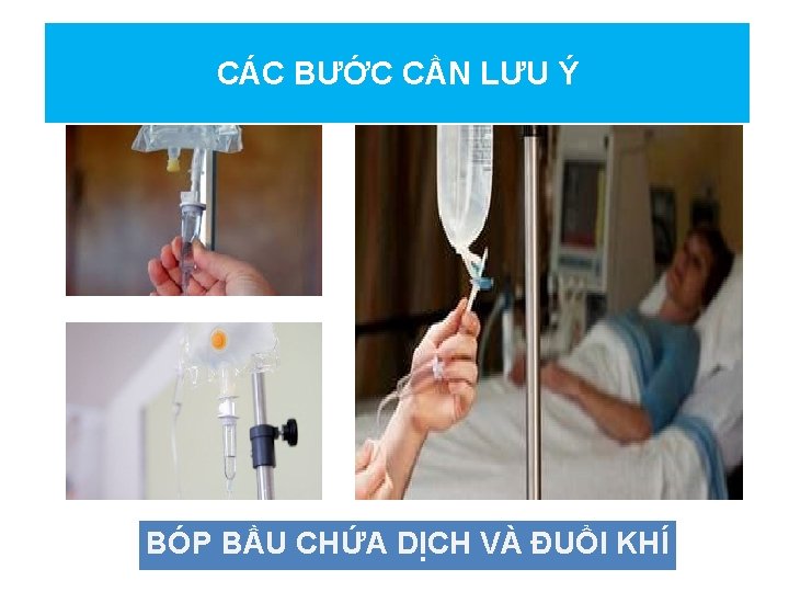 CÁC BƯỚC CẦN LƯU Ý BÓP BẦU CHỨA DỊCH VÀ ĐUỔI KHÍ 