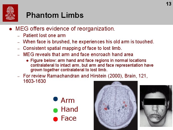 13 Phantom Limbs l MEG offers evidence of reorganization. – – Patient lost one