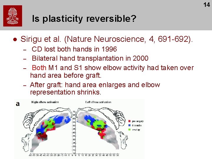 14 Is plasticity reversible? l Sirigu et al. (Nature Neuroscience, 4, 691 -692). –