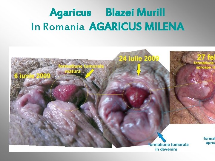Agaricus Blazei Murill In Romania AGARICUS MILENA 