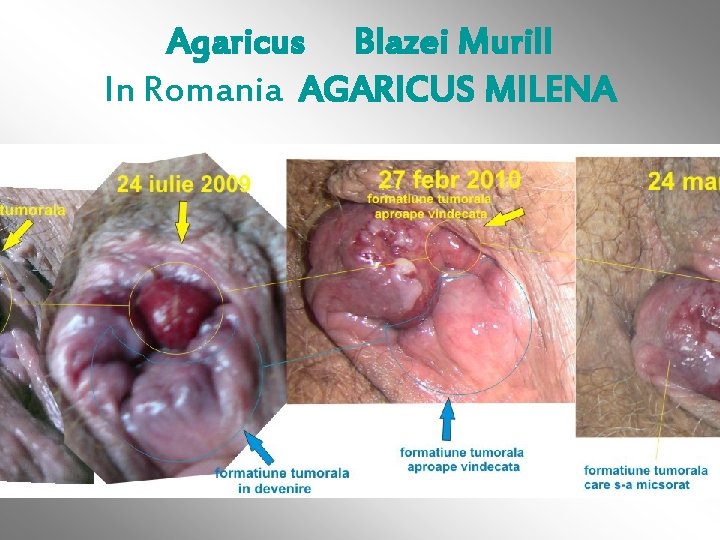 Agaricus Blazei Murill In Romania AGARICUS MILENA 