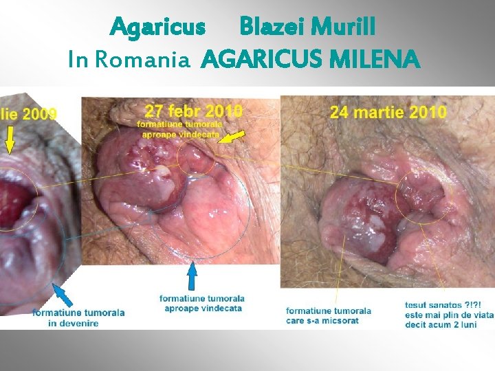 Agaricus Blazei Murill In Romania AGARICUS MILENA 