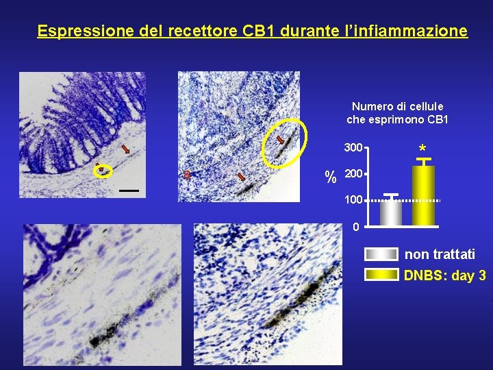 Espressione del recettore CB 1 durante l’infiammazione Numero di cellule che esprimono CB 1