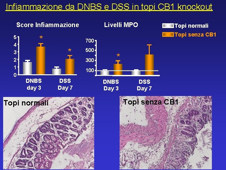 Infiammazione da DNBS e DSS in topi CB 1 knockout Score Infiammazione 5 4