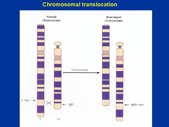 Chromosomal translocation 