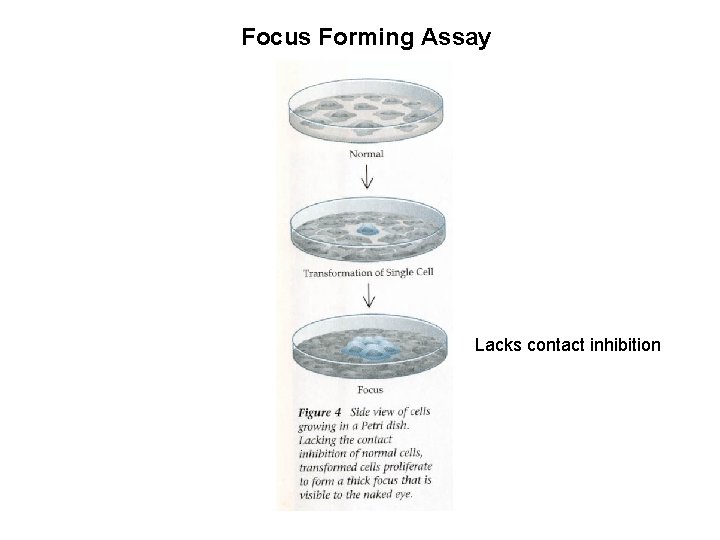 Focus Forming Assay Lacks contact inhibition 