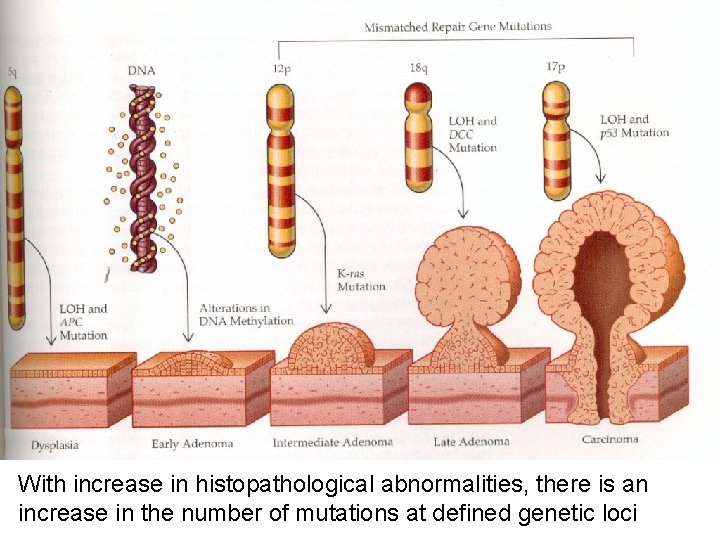 With increase in histopathological abnormalities, there is an increase in the number of mutations