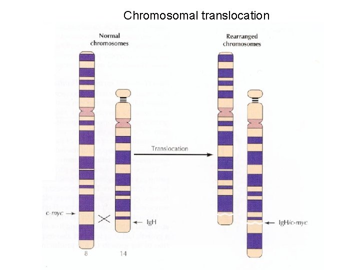 Chromosomal translocation 