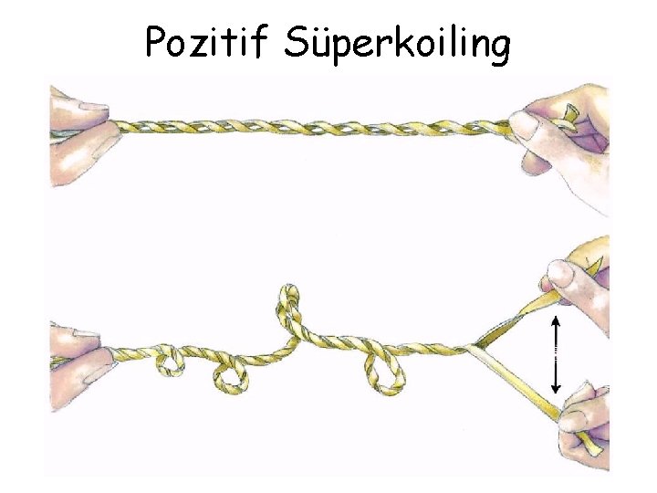 Pozitif Süperkoiling 