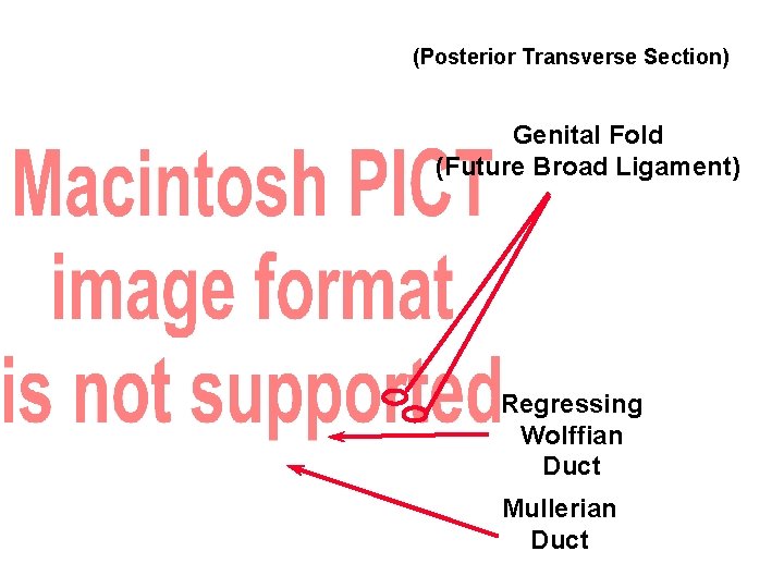 (Posterior Transverse Section) Genital Fold (Future Broad Ligament) Regressing Wolffian Duct Mullerian Duct 