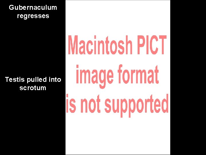Gubernaculum regresses Testis pulled into scrotum 