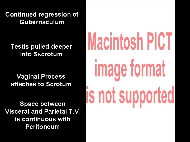 Continued regression of Gubernaculum Testis pulled deeper into Sscrotum Vaginal Process attaches to Scrotum