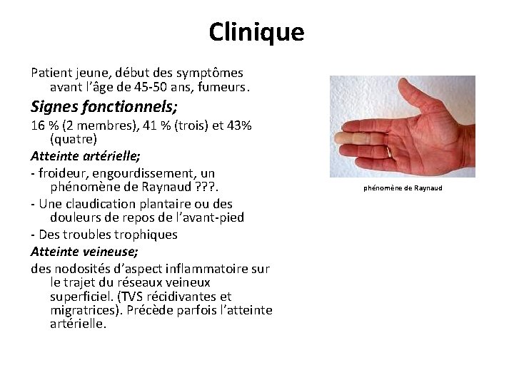 Clinique Patient jeune, début des symptômes avant l’âge de 45 -50 ans, fumeurs. Signes