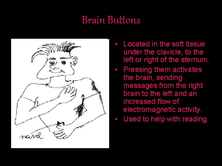 Brain Buttons • Located in the soft tissue under the clavicle, to the left