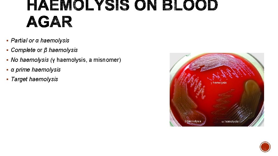 § Partial or α haemolysis § Complete or β haemolysis § No haemolysis (γ